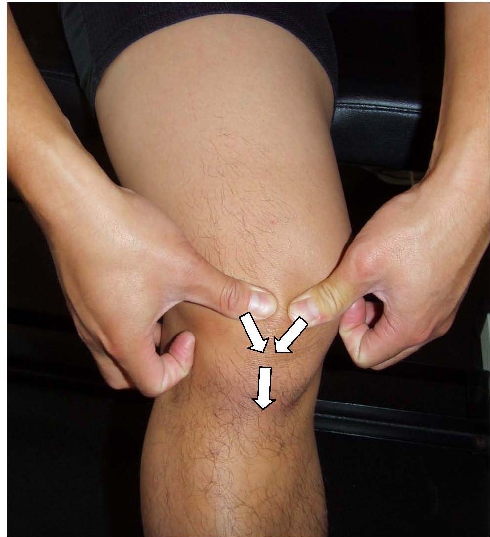 Knee mobs